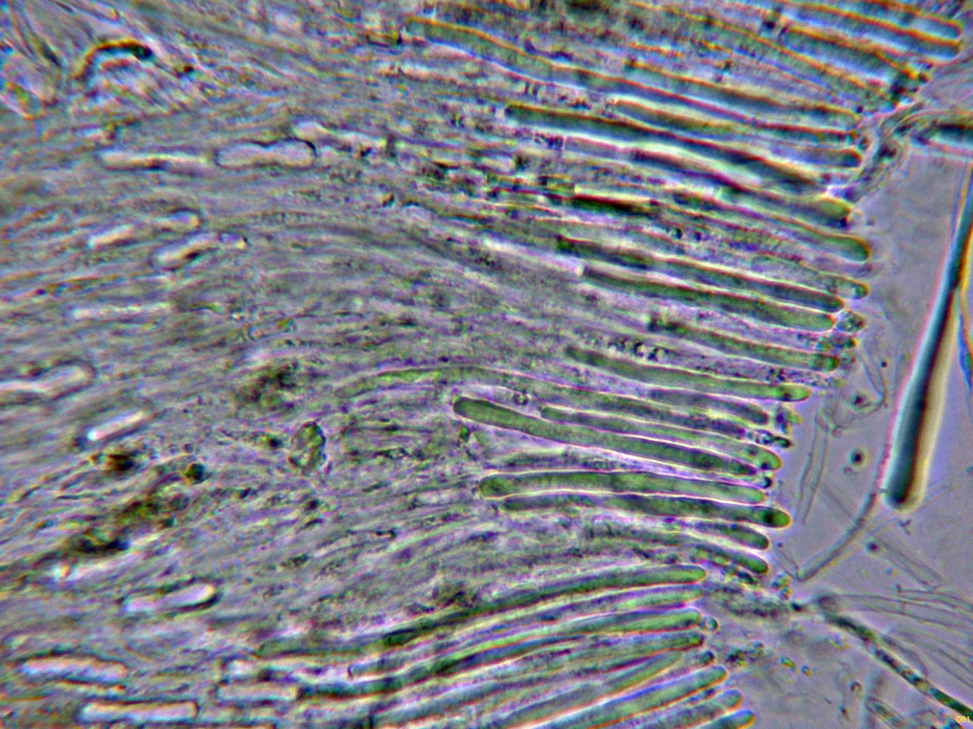 Microscopía de Strossmayeria basitricha - 10 - Hifas marginales agua-001